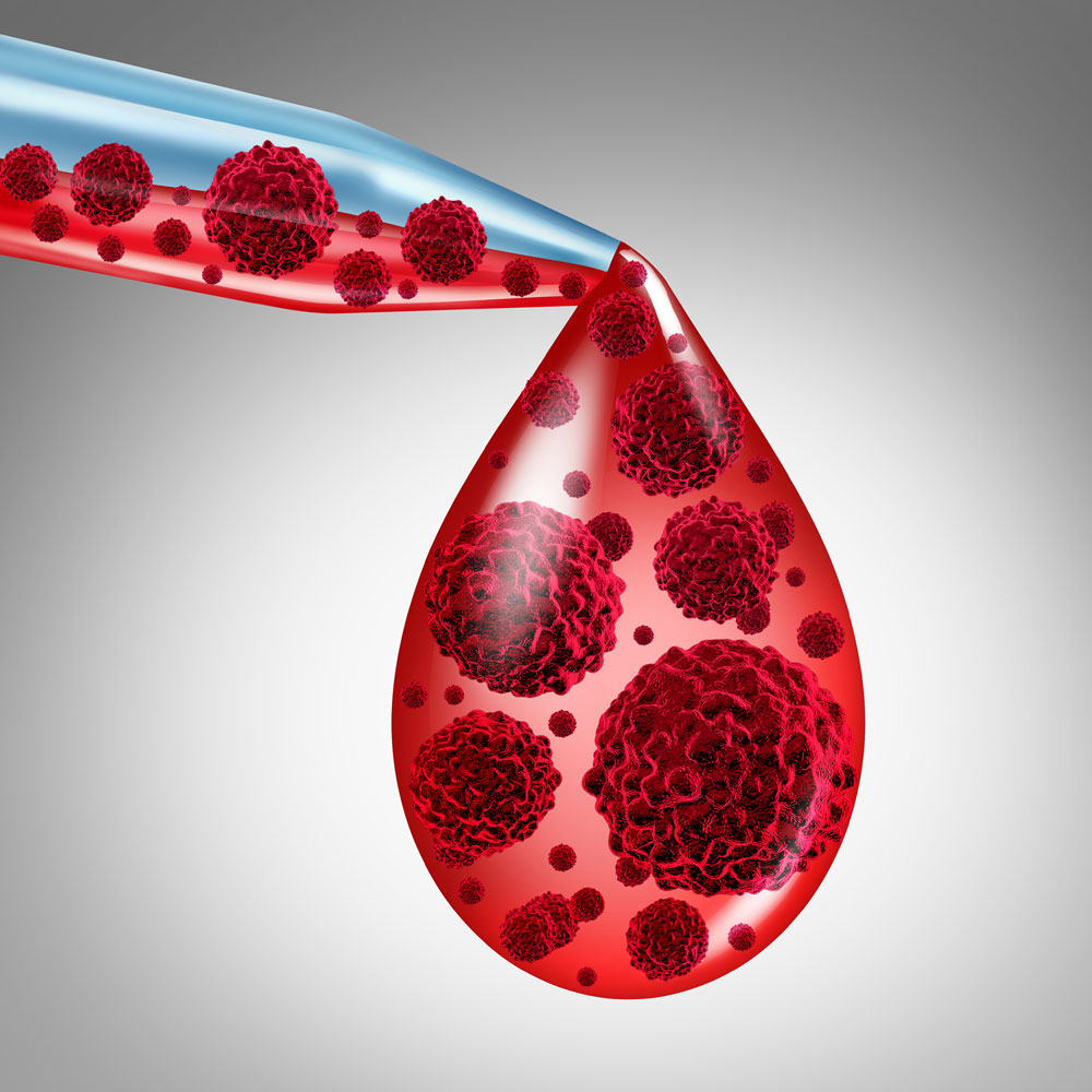 Image of blood with cancer cells in a pipette